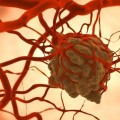 Metastazele ar putea avea o natură aleatorie, cred oamenii de știință
