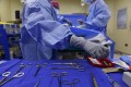 Tratamentul chirurgical al cancerului și biopsia ar putea influența progresul bolii