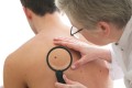 Legătura dintre colagen și cancerul de piele