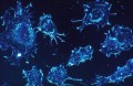 Identificarea riscului de cancer pe baza analizei densității celulare