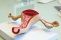 Cadmiul ar putea crește riscul de cancer endometrial