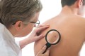 Diagnosticul mai rapid al melanomului cu ajutorul inteligenţei artificiale