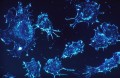 Inteligența artificială, folosită pentru detectarea cancerului colorectal cu precizie de 86%