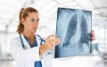 O nouă strategie de tratare a cancerului pulmonar cu mutații pe gena K-RAS