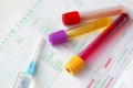 O nouă tehnică de biopsie lichidă pentru detectarea cancerului în sânge