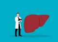 Indiferent de vârstă, transplantul rămâne standardul de îngrijire pentru pacienții cu cancer hepatic