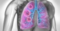 Cercetătorii au dezvoltat un vaccin care ar putea preveni răspândirea metastazelor cancerigene la plămâni